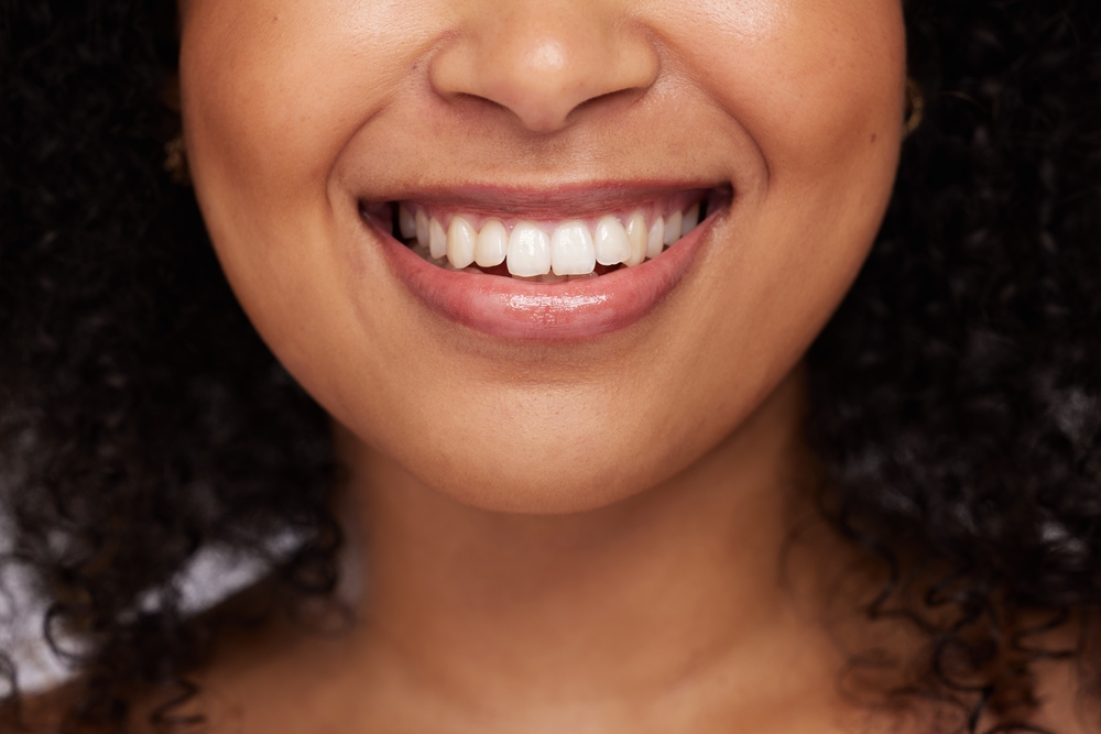 Cosmetic Dentistry for the Santa Cruz Community Black woman, teeth and smile for dental care, whitening or oral and mouth treatment. Closeup of happy African American female model smiling for dentist results, healthcare or clean tooth hygiene