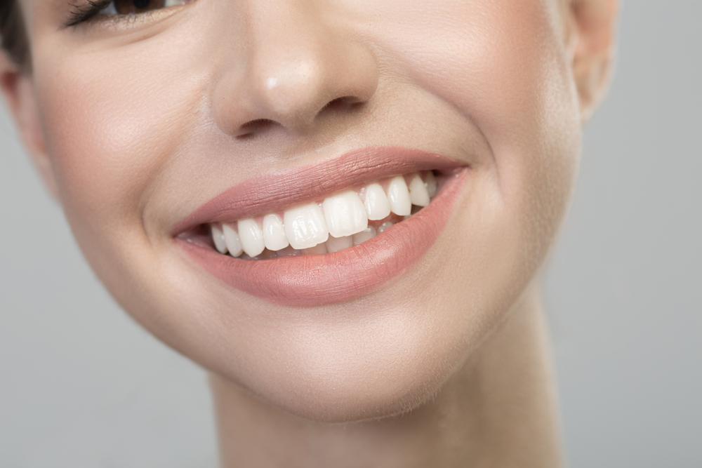 Teeth Whitening Results at Mt. Hermon Dental Care, Scotts Valley Close up of happy smile of optimistic cute girl with straight white healthy teeth. Oral care concept