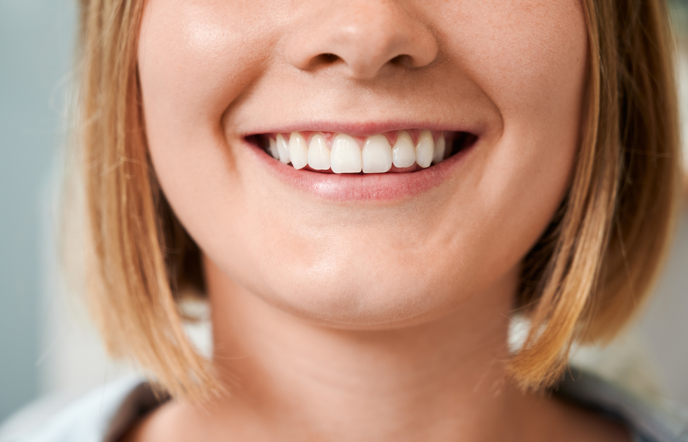 Confident Smiles from Dental Care in Scotts Valley Cropped snapshot of a beautiful female smile demonstrating perfect teeth.