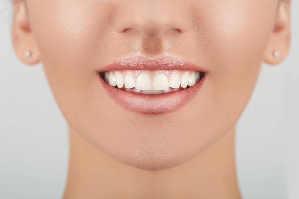 Teeth Whitening Results at Mt. Hermon Dental Care, Scotts Valley Healthy white smile. Beauty woman with perfect smile, lips and white teeth. Beautiful Model Girl with clear skin. Teeth whitening and cleaning, dental care.