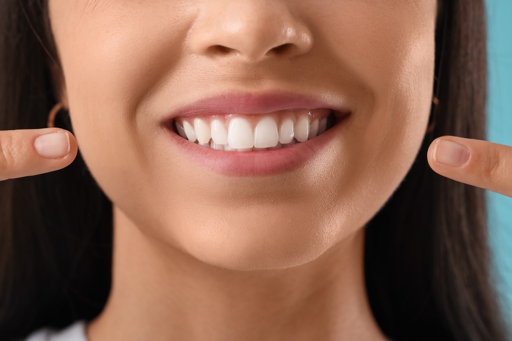 Teeth Whitening Results at Mt. Hermon Dental Care, Scotts Valley Young woman pointing at her healthy teeth on blue background, closeup